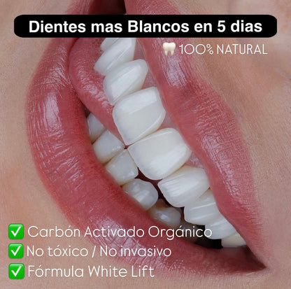 UltraWhite Carbon - Blanqueador Dental
