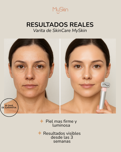 Varita - SkinCare