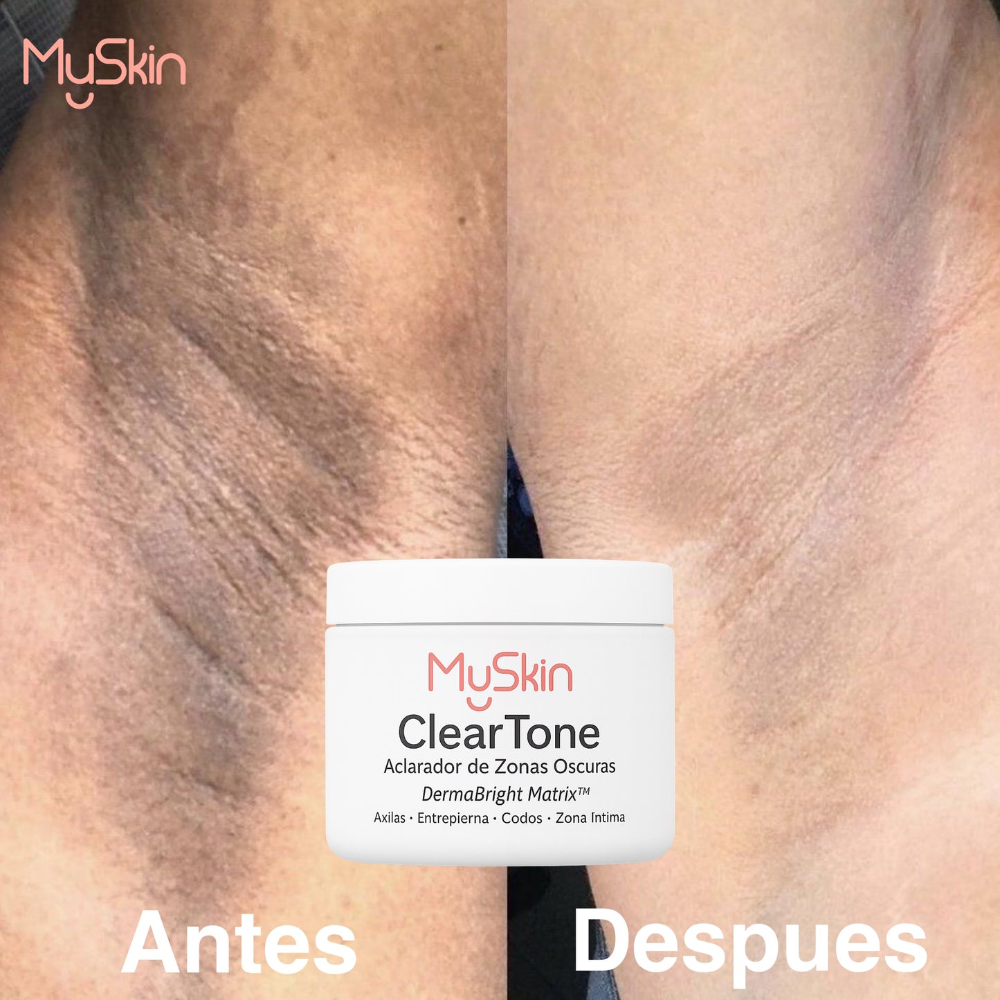 ClearTone  – Aclarador de Zonas Oscuras