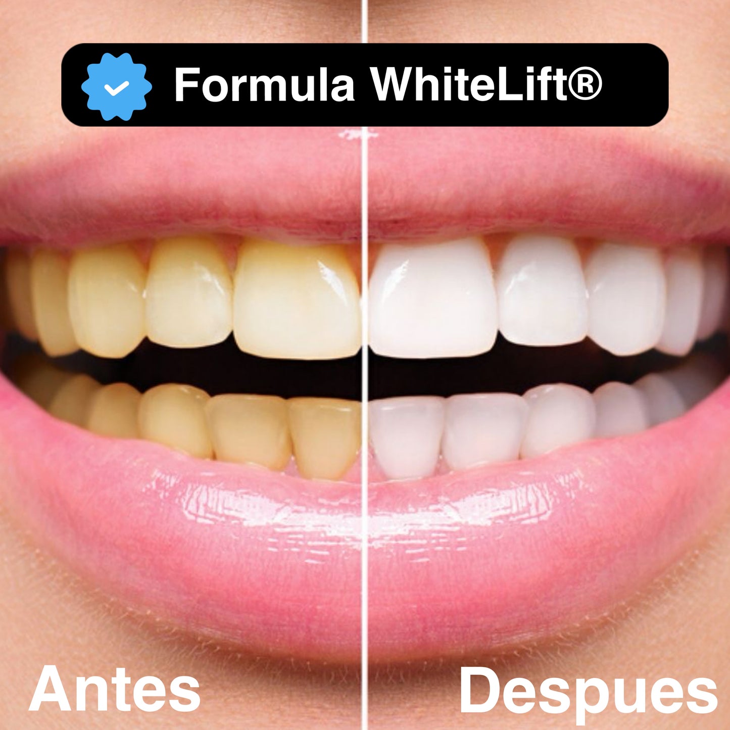 UltraWhite Carbon - Blanqueador Dental
